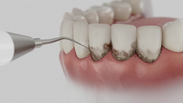Trusted Invisalign Clear Aligners service in Walker Mill, MD - Dentist Open Now